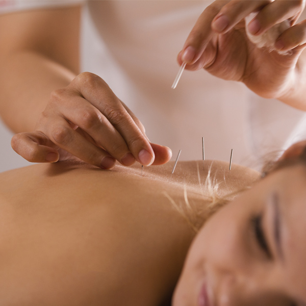 Chinese Massage in Dubai Industrial City Massage Chinese Massage in Dubai Industrial City Massage